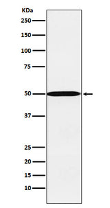 Anti-CYP26A1 Rabbit Monoclonal Antibody Boster Bio