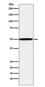 Anti-CYP26A1 Rabbit Monoclonal Antibody Boster Bio