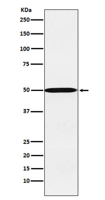 Anti-CYP26A1 Rabbit Monoclonal Antibody Boster Bio