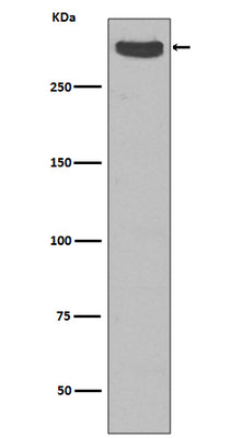 Anti-Cubilin CUBN Rabbit Monoclonal Antibody Boster Bio