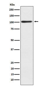 Anti-Alpha actinin 2 Rabbit Monoclonal Antibody Boster Bio
