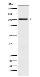 Anti-Alpha actinin 2 Rabbit Monoclonal Antibody Boster Bio