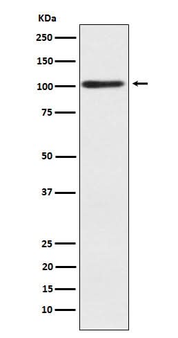 Anti-Alpha actinin 2 Rabbit Monoclonal Antibody Boster Bio