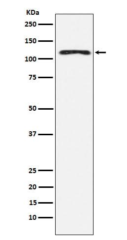 Anti-HLTF Rabbit Monoclonal Antibody Boster Bio