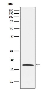 Anti-Claudin 4 Monoclonal Antibody Boster Bio