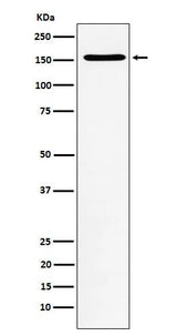 Anti-WAPL Rabbit Monoclonal Antibody Boster Bio