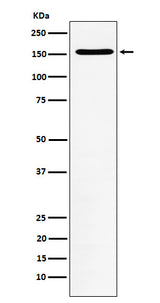 Anti-WAPL Rabbit Monoclonal Antibody Boster Bio