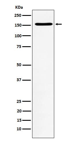 Anti-WAPL Rabbit Monoclonal Antibody Boster Bio