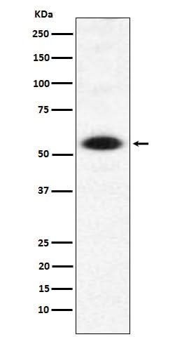 Anti-DMAP1 Rabbit Monoclonal Antibody Boster Bio