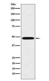 Anti-Renin Rabbit Monoclonal Antibody Boster Bio