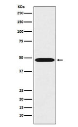 Anti-Renin Rabbit Monoclonal Antibody Boster Bio