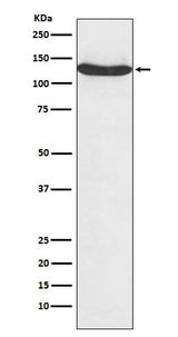 Anti-hnRNP U Monoclonal Antibody Boster Bio