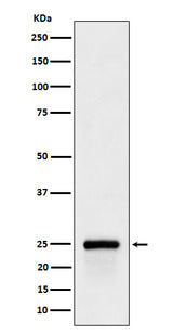 Anti-GSTA4 Rabbit Monoclonal Antibody Boster Bio