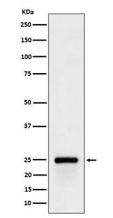 Anti-GSTA4 Rabbit Monoclonal Antibody Boster Bio
