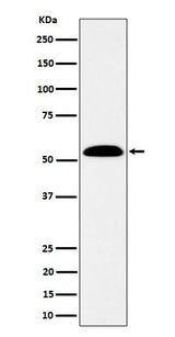 Anti-ALDH7A1 Rabbit Monoclonal Antibody Boster Bio
