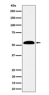 Anti-ALDH7A1 Rabbit Monoclonal Antibody Boster Bio