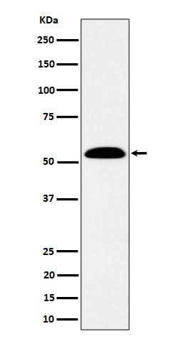 Anti-ALDH7A1 Rabbit Monoclonal Antibody Boster Bio