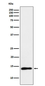 Anti-TCL1 Monoclonal Antibody Boster Bio