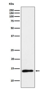 Anti-TCL1 Monoclonal Antibody Boster Bio