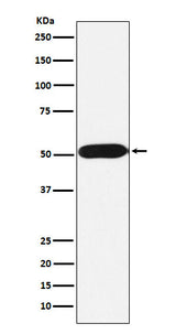 Anti-FKBP38 Rabbit Monoclonal Antibody Boster Bio