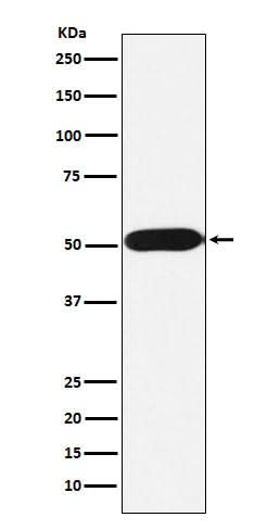 Anti-FKBP38 Rabbit Monoclonal Antibody Boster Bio