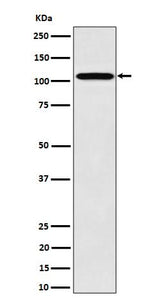 Anti-Nup107 Rabbit Monoclonal Antibody Boster Bio