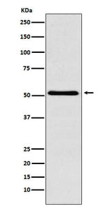Anti-BAF57/SMARCE1 Rabbit Monoclonal Antibody Boster Bio