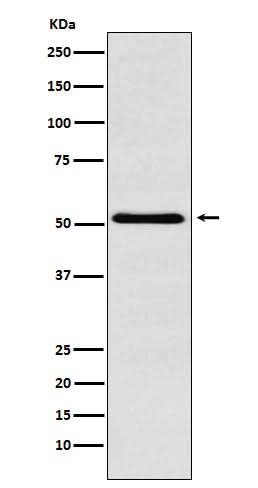 Anti-BAF57/SMARCE1 Rabbit Monoclonal Antibody Boster Bio