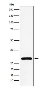 Anti-NEK6 Rabbit Monoclonal Antibody Boster Bio