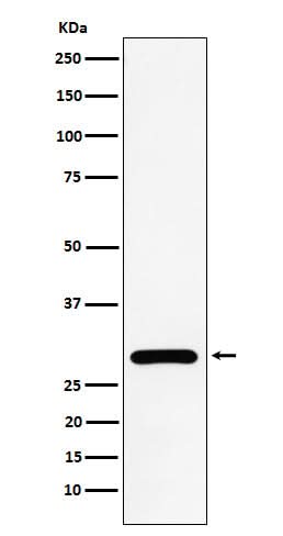 Anti-NEK6 Rabbit Monoclonal Antibody Boster Bio