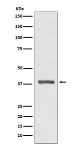 Anti-AMPK beta 1 PRKAB1 Rabbit Monoclonal Antibody Boster Bio