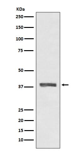 Anti-AMPK beta 1 PRKAB1 Rabbit Monoclonal Antibody Boster Bio