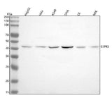 Anti-S1PR3 Rabbit Monoclonal Antibody Boster Bio
