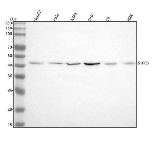 Anti-S1PR3 Rabbit Monoclonal Antibody Boster Bio