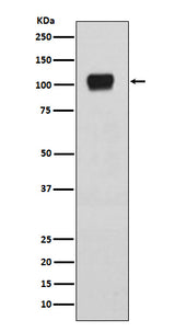Anti-ATG9A Rabbit Monoclonal Antibody Boster Bio