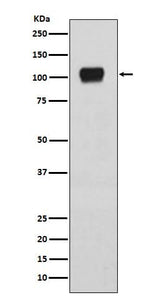 Anti-ATG9A Rabbit Monoclonal Antibody Boster Bio