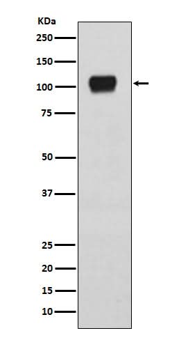 Anti-ATG9A Rabbit Monoclonal Antibody Boster Bio