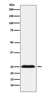 Anti-BAP31 Rabbit Monoclonal Antibody Boster Bio