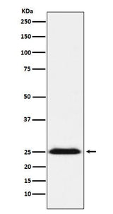 Anti-BAP31 Rabbit Monoclonal Antibody Boster Bio