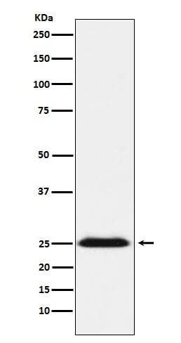 Anti-BAP31 Rabbit Monoclonal Antibody Boster Bio
