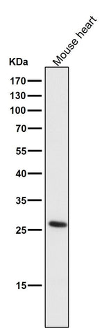 Anti-CD20 MS4A1 Rabbit Monoclonal Antibody Boster Bio