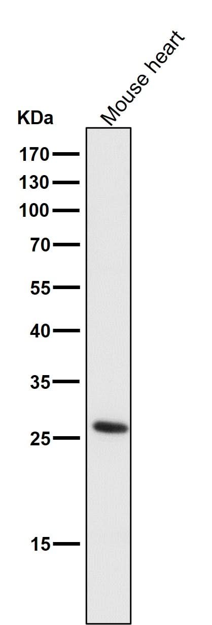 Anti-CD20 MS4A1 Rabbit Monoclonal Antibody Boster Bio