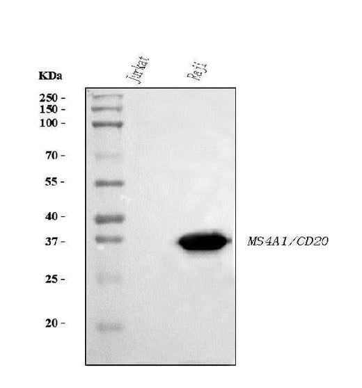 Anti-CD20 Antibody Picoband® (monoclonal, 4D11 Boster Bio