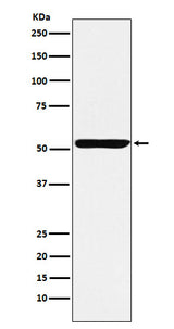Anti-Nuf2 Rabbit Monoclonal Antibody Boster Bio