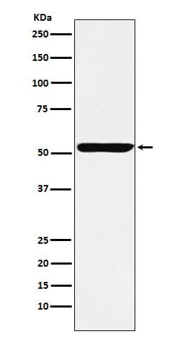 Anti-Nuf2 Rabbit Monoclonal Antibody Boster Bio