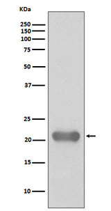 Anti-Smac/Diablo Rabbit Monoclonal Antibody Boster Bio
