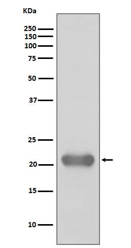 Anti-Smac/Diablo Rabbit Monoclonal Antibody Boster Bio