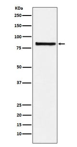 Anti-eIF2B epsilon Rabbit Monoclonal Antibody Boster Bio