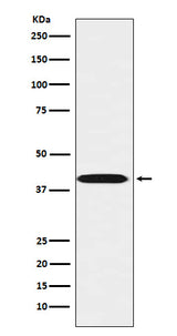 Anti-LHX3 Rabbit Monoclonal Antibody Boster Bio