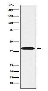 Anti-LHX3 Rabbit Monoclonal Antibody Boster Bio